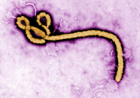 El virus del ébola es observado bajo microscopio (Getty Images)