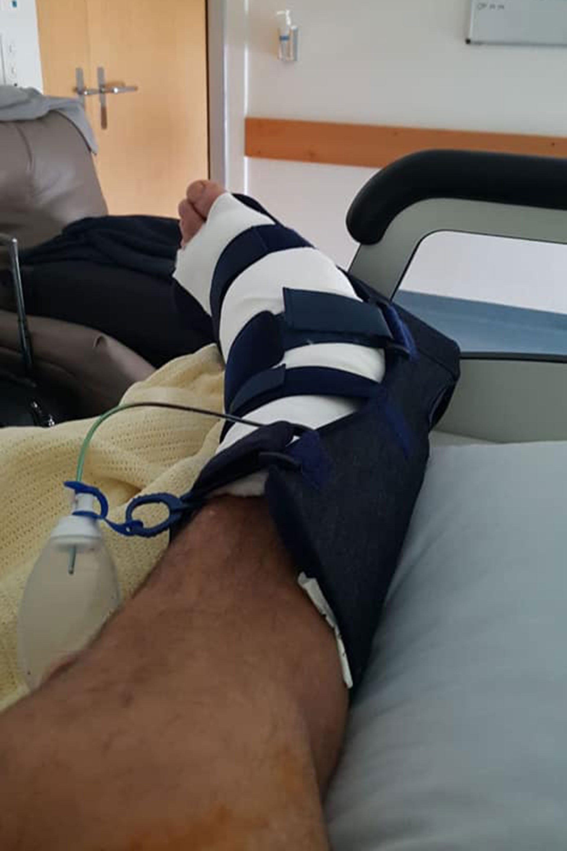 Así quedó el tobillo de Batistuta después de la operación en una clínica en Suiza (@GBatistutaOK)