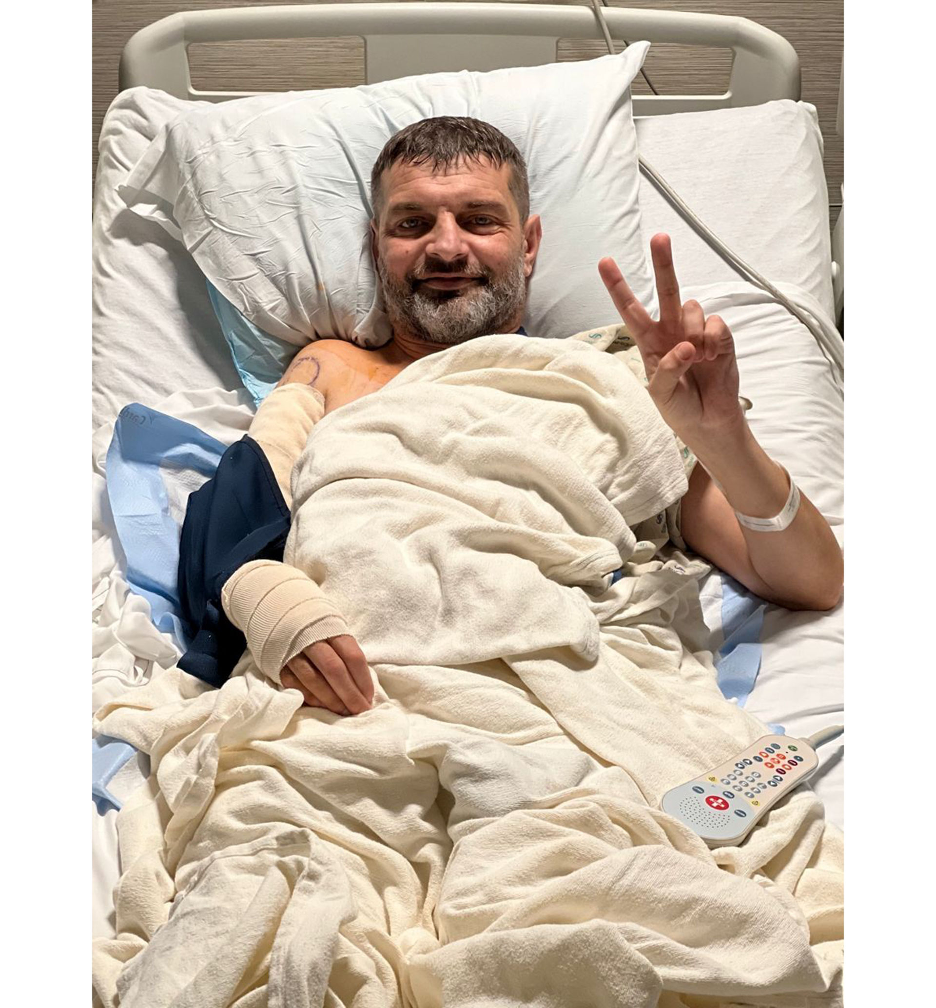 Ukrainian soldier Mykhailo Dianov underwent surgery on his arm in the United States and is recovering after Russian captivity 2 Ukrainian soldier Mykhailo Dianov after his operation in the US