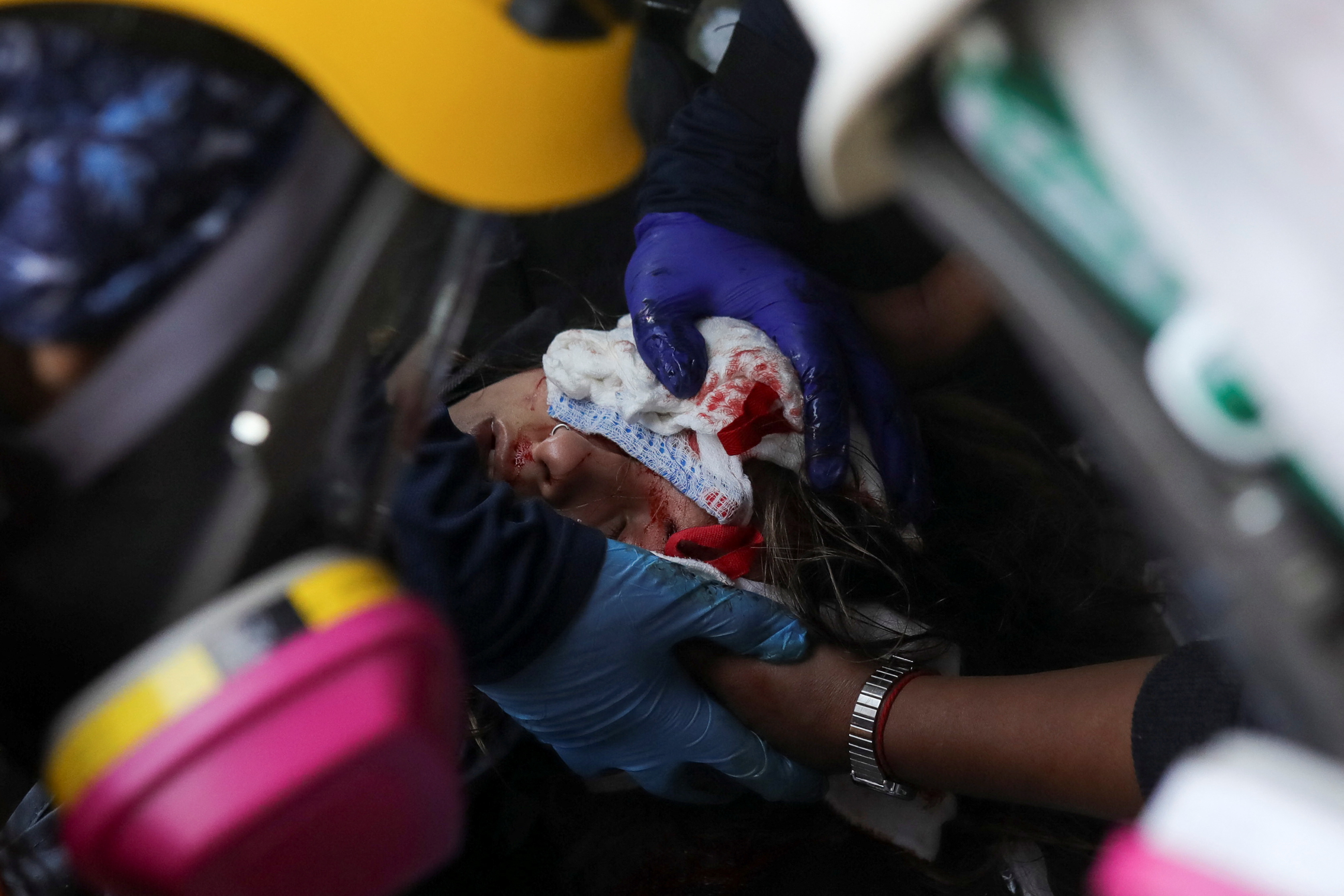 Una mujer herida recibe atención médica (Reuters)