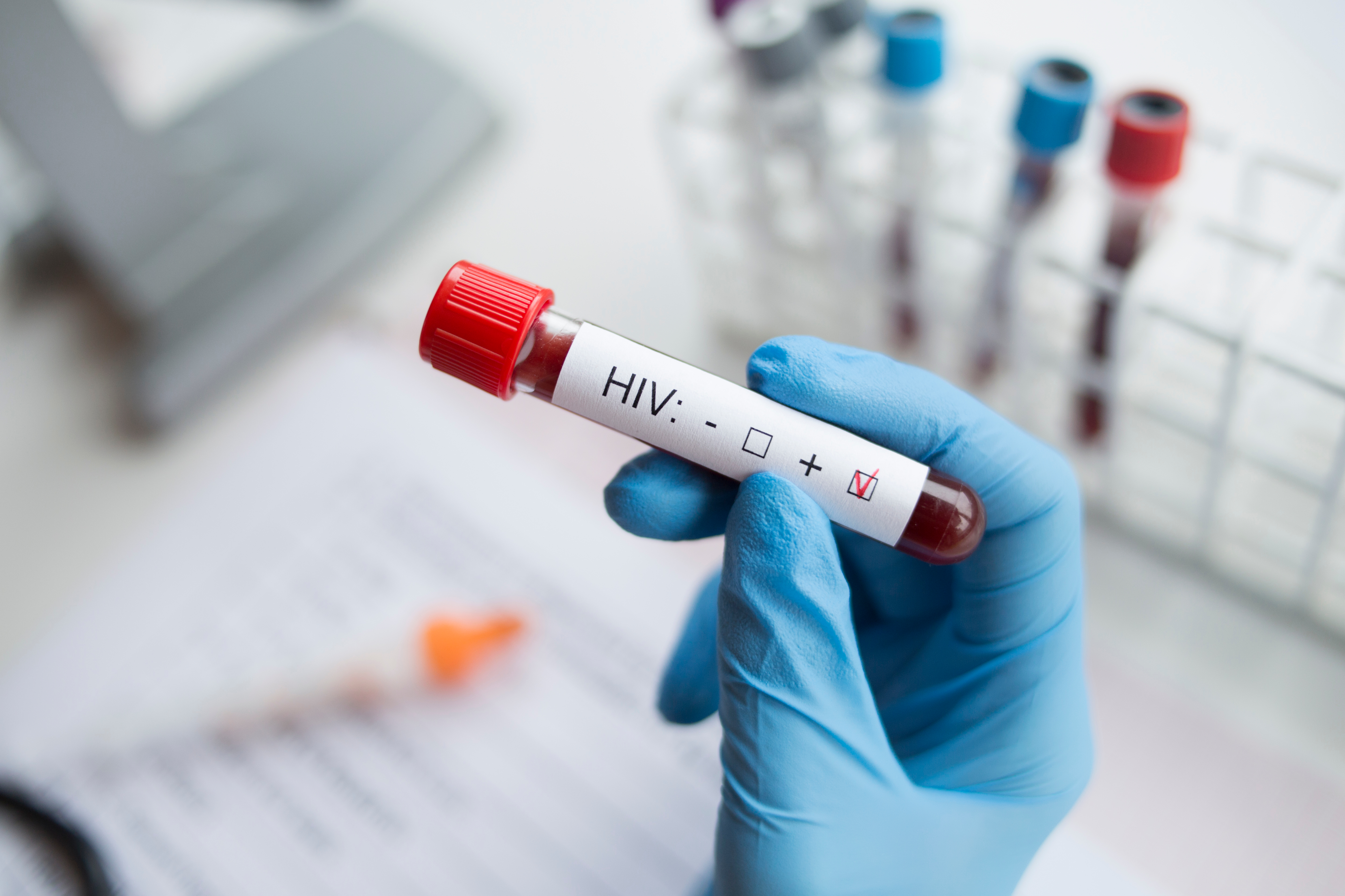 Las primeras dosis de una vacuna contra el SIDA con tecnología de ARN mensajero se han administrado a seres humanos