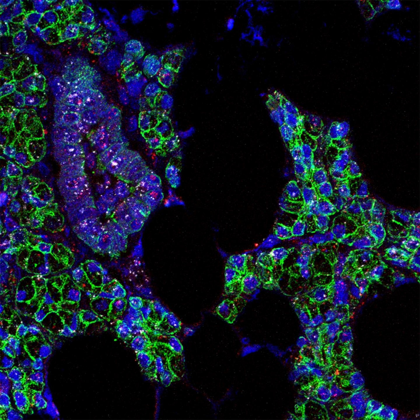 El ARN del SARS-CoV-2 (rosa) y del receptor ACE2 (blanco) encontrados en las células de las glándulas salivales humanas, que se han señalado en verde. EFE/Paola Perez/Instituto Nacional de Investigación Dental y Craneofacial.
