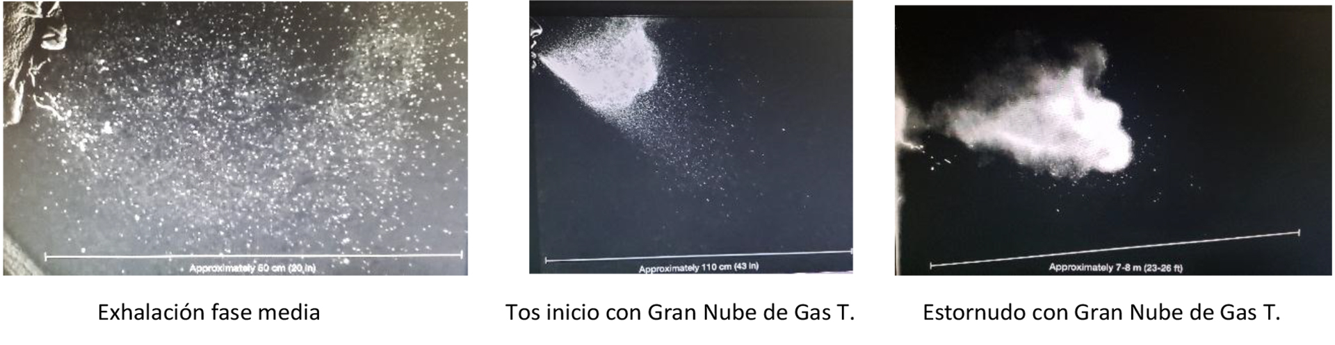 Exhalacion, Tos y Estornudo con 1000 f/s. En Tos y Estornudo observen el comienzo de la Nube de Gas Turbulenta. (Turbulent Gas Clouds and Respiratory Pathogen Emissions Potential Implications for Reducing
Transmission of COVID-19. Lydia Bourouiba, PhD JAMA. March 26, 2020. doi:10.1001/jama.2020.4756)