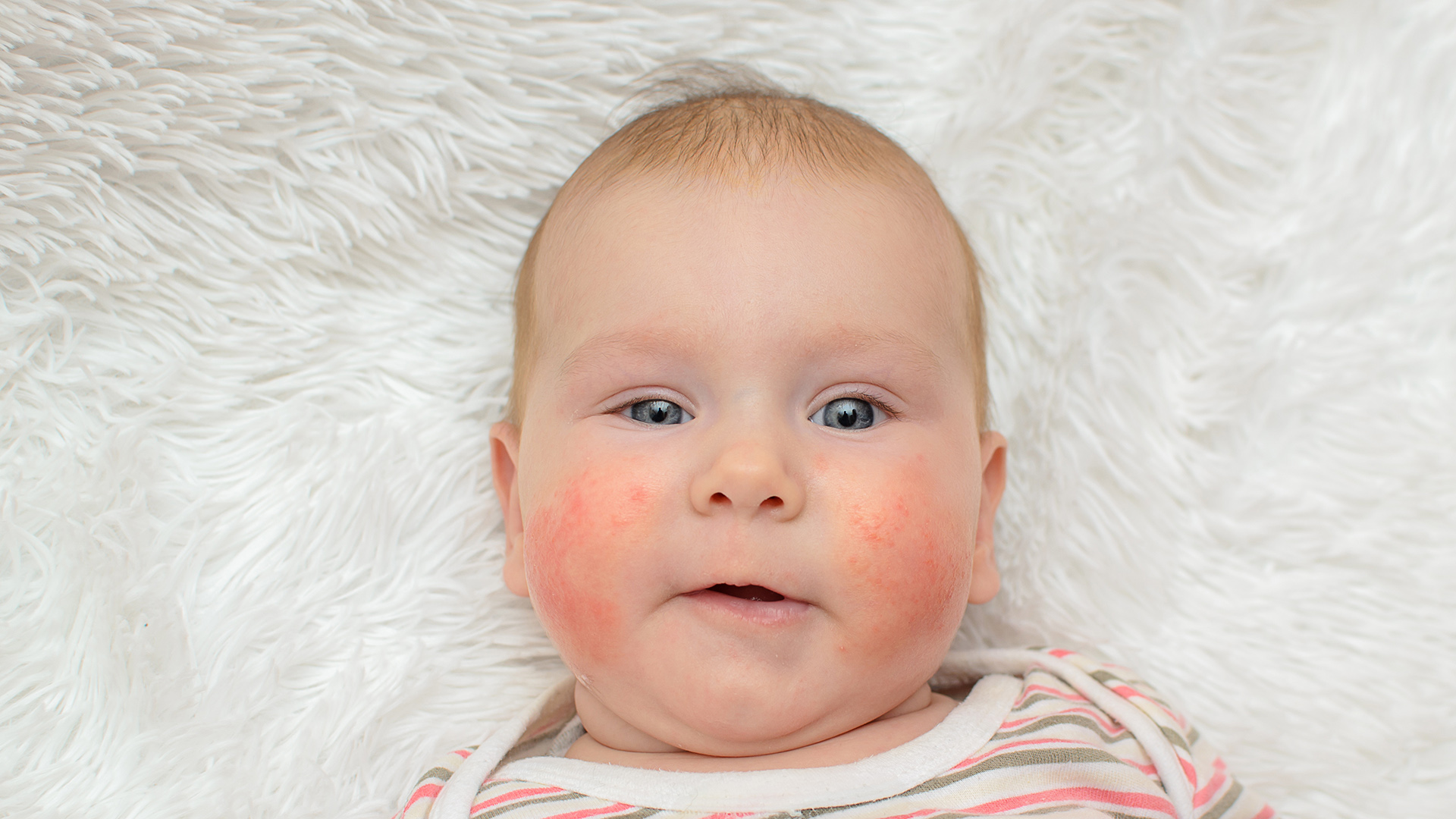 La alergia a la leche afecta principalmente a los niños (Shutterstock)