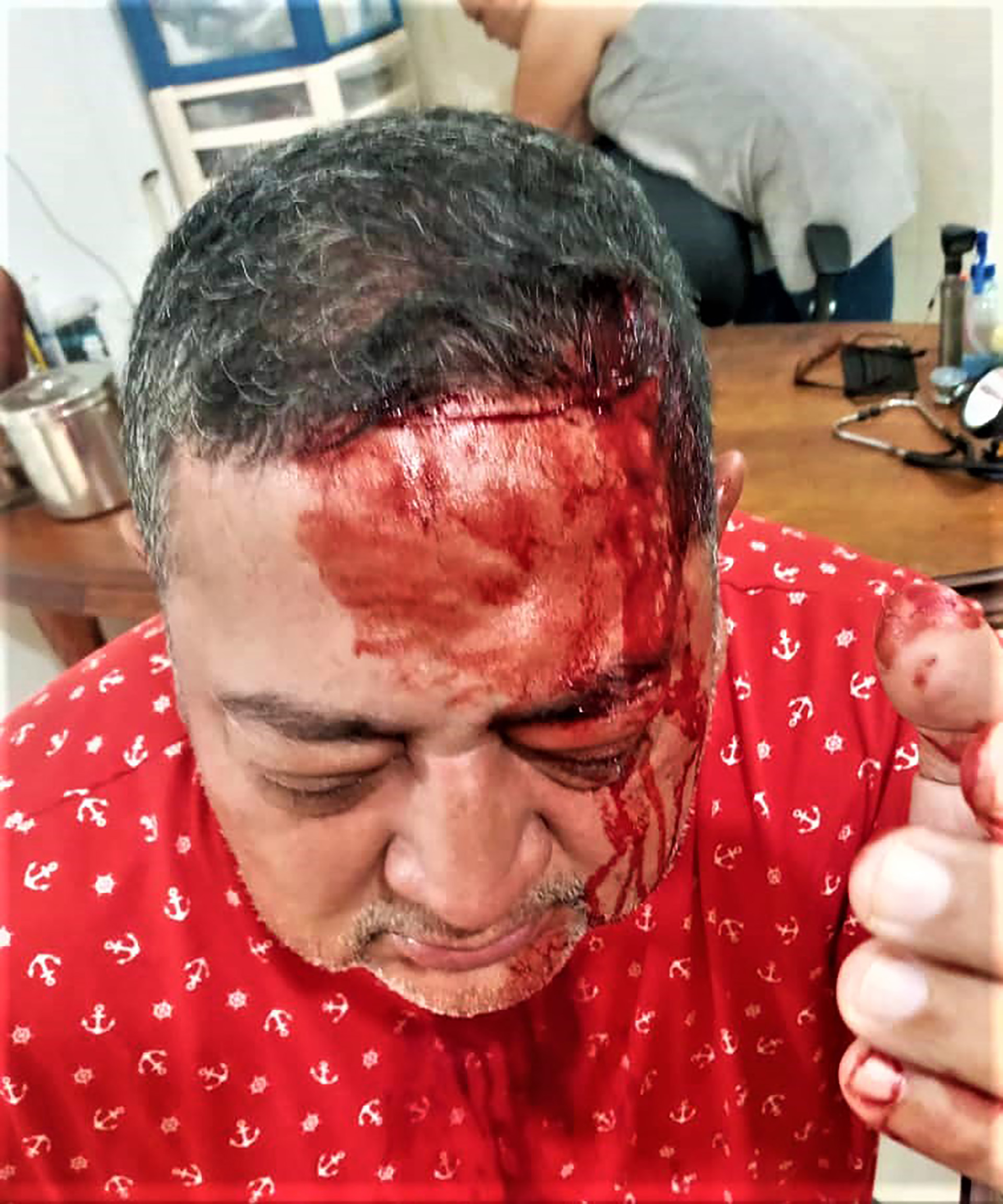 Harold José Maldonado Escorihuela fue golpeado y amenazado por la guerrilla para que retire su candidatura