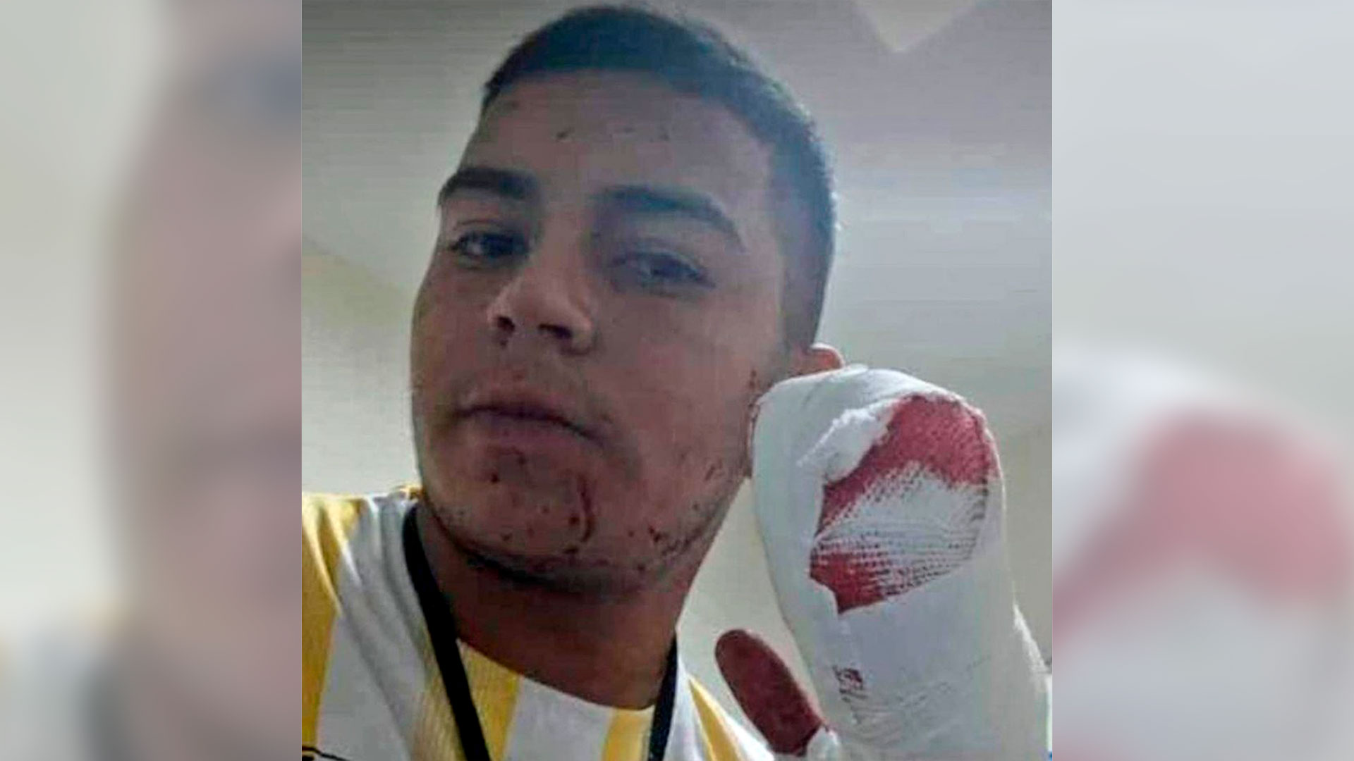 Martín Abraham, el joven que perdió cuatro dedos durante un intento de robo