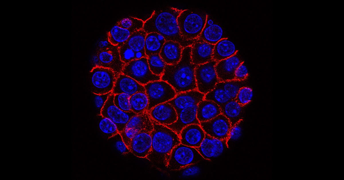 Moderna ya busca una forma de enfrentar al cáncer y, para ello, pondrá a su plataforma estrella a disposición; el ARNm / CREDIT: National Cancer Institute