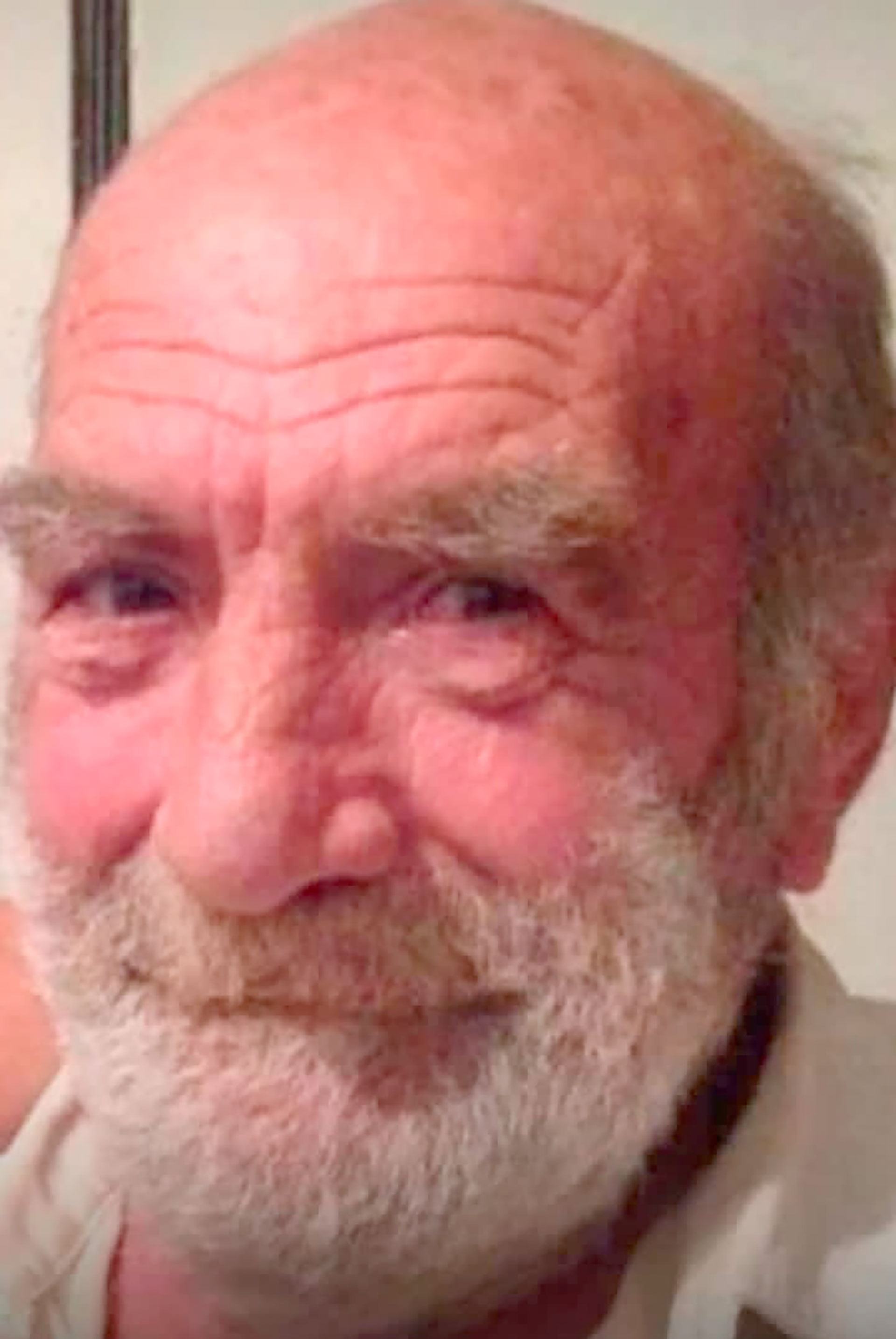 Silva falleció este domingo luego de mendigar atención médica y peregrinar por varios centros de salud durante los últimos cuatro meses