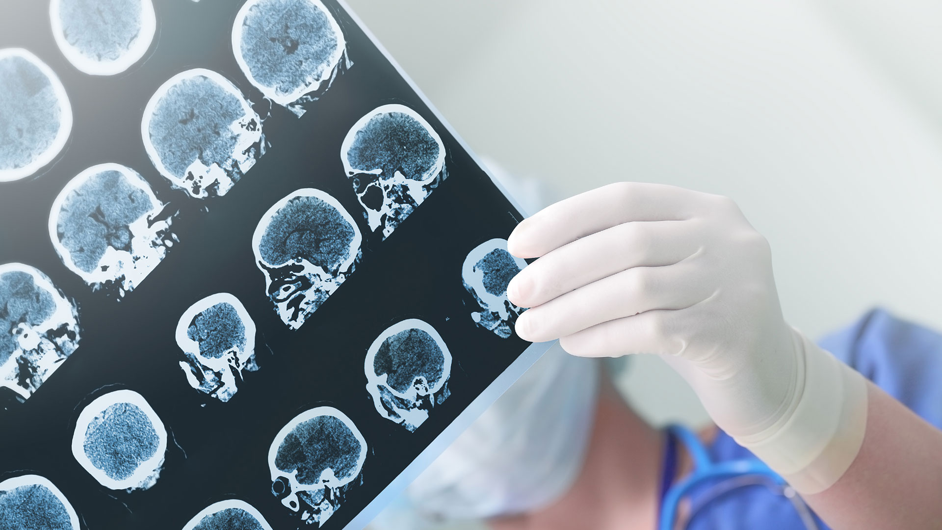 El Hospital General de Massachusetts desarrolló recientemente un método preciso para la detección de Alzheimer que se basa en muestras clínicas cerebrales recolectadas en forma de imágenes en exámenes de rutina (Getty)