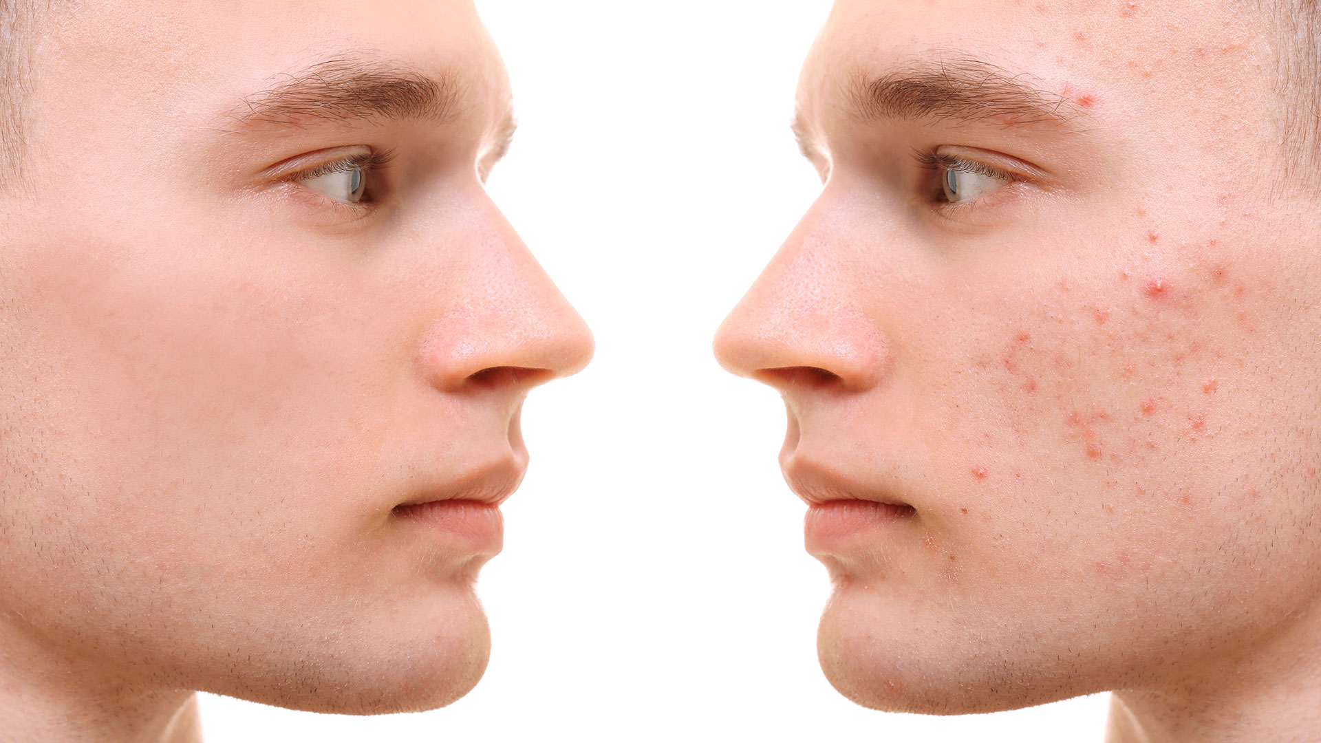 Rostro con imperfecciones cutáneas