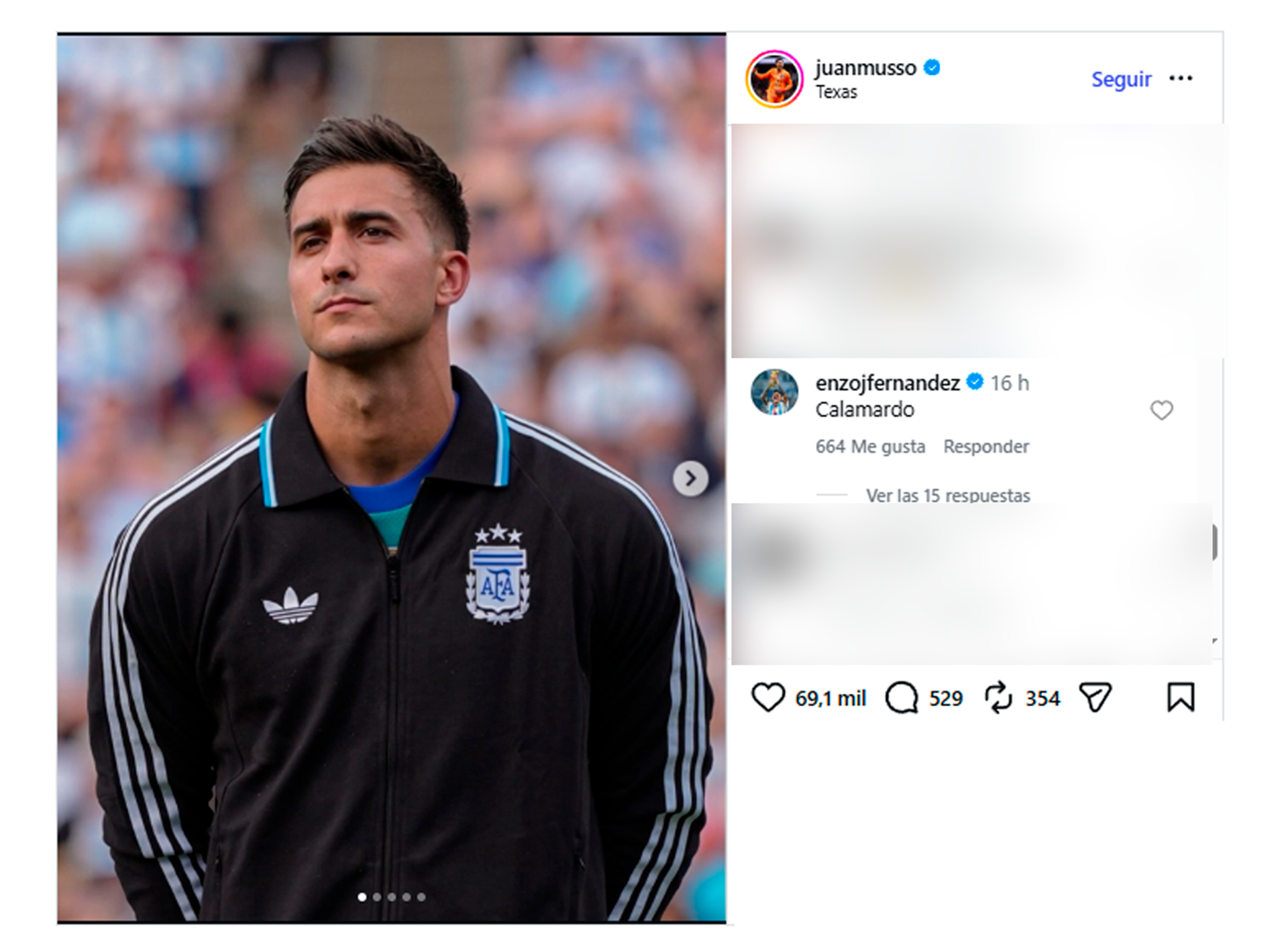 El singular apodo que Enzo Fern&aacute;ndez le puso a Juan Musso y gener&oacute; las reacciones de los jugadores de la Scaloneta