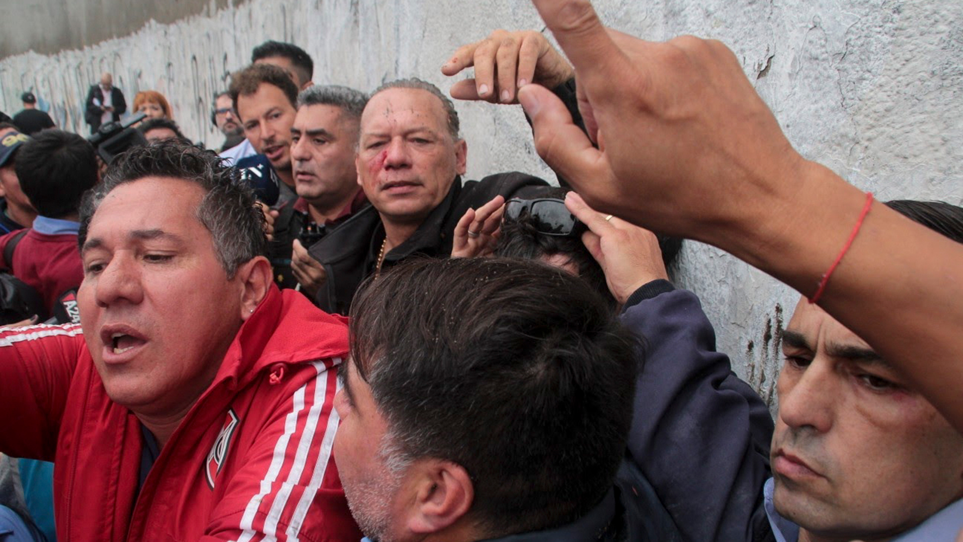 Sergio Berni tuvo que ser atendido en el Hospital Churruca como consecuencia de los golpes recibidos (AP Photo/Andres Pelozo)