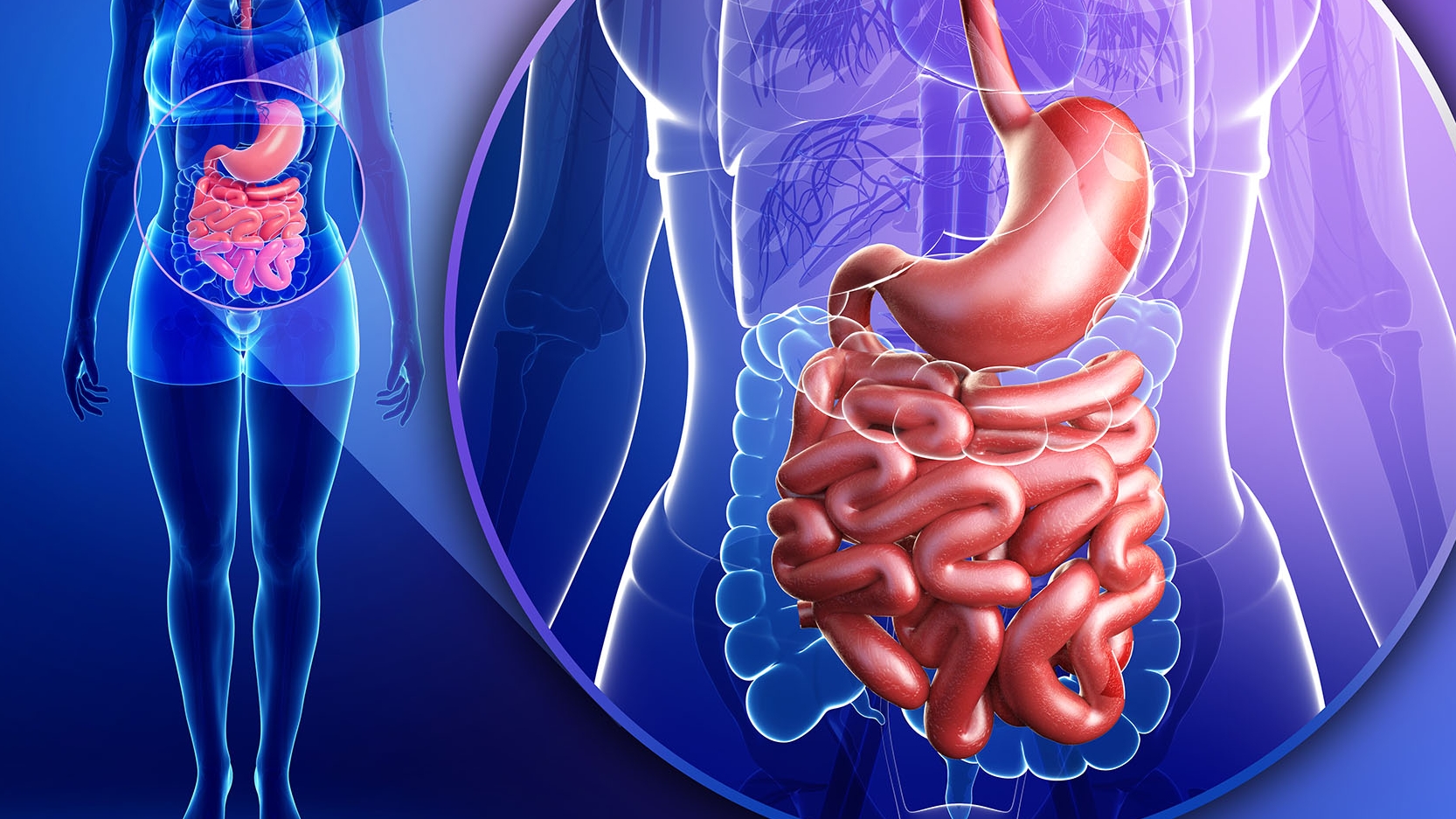 En la investigación, hallaron que la ingesta de microplásticos puede producir inflamación intestinal (Getty)