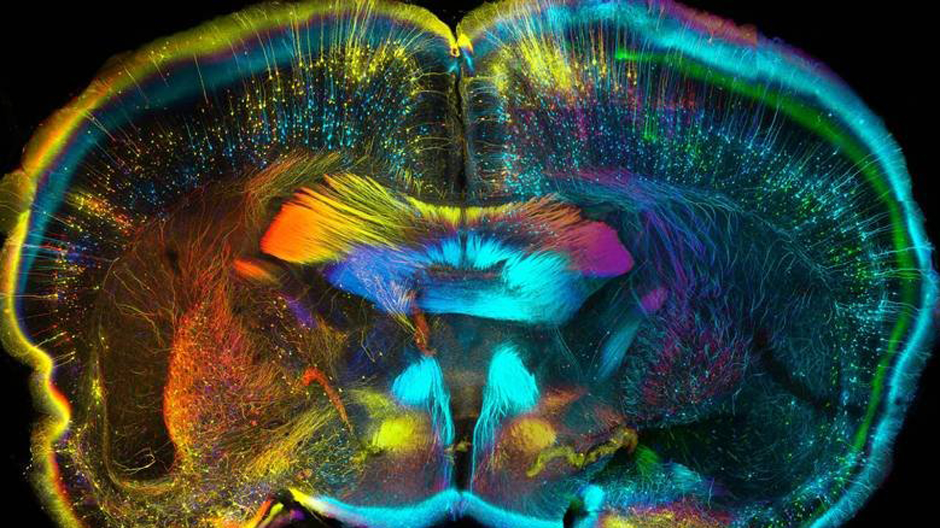 Visión psicodélica del cerebro durante el consumo de LSD (M.Balbi)