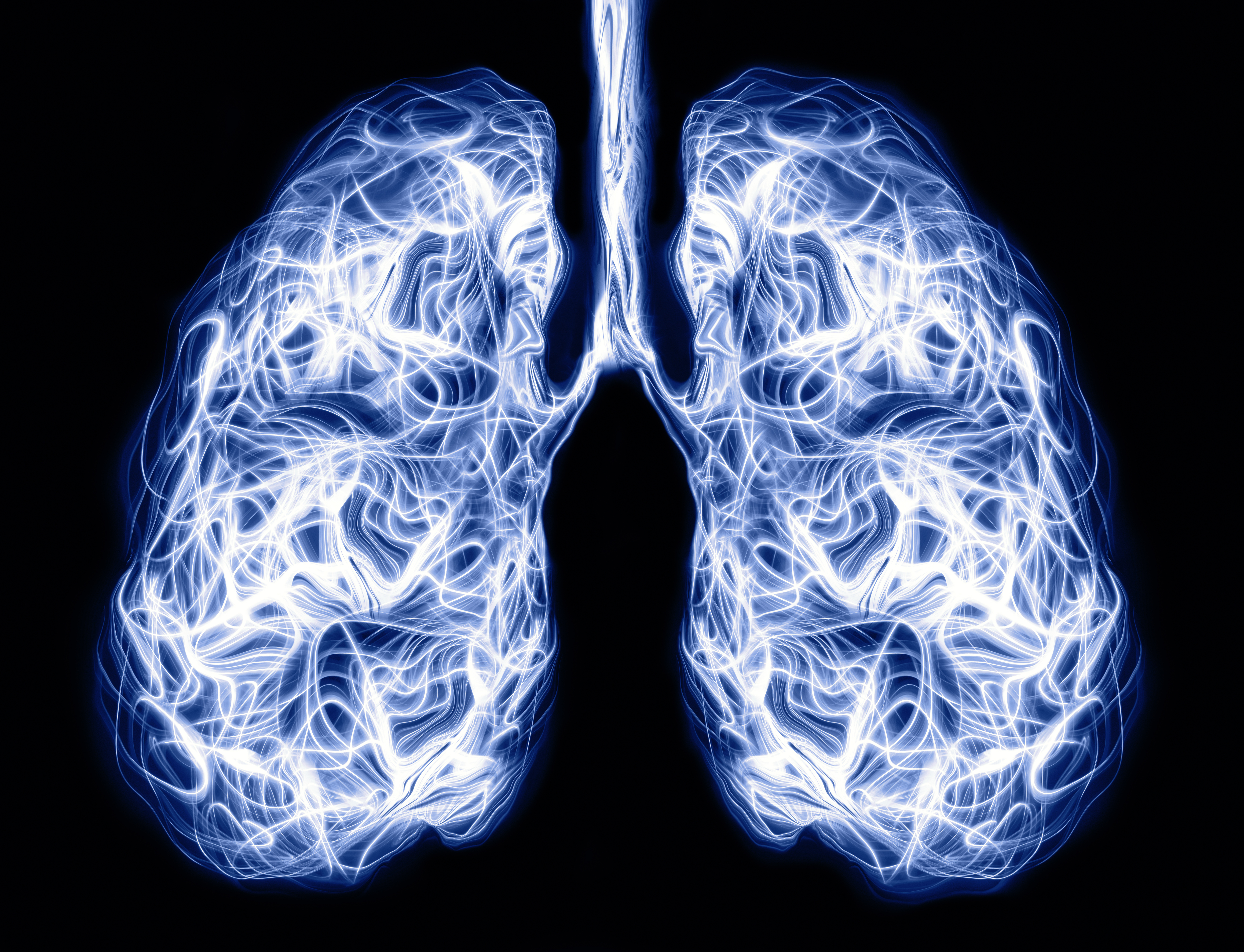 Tras las reinfecciones, hubo más pacientes con falta de aire, escasez de oxígeno en la sangre, enfermedad pulmonar y acumulación de líquido alrededor de los pulmones (Gettyimages)
