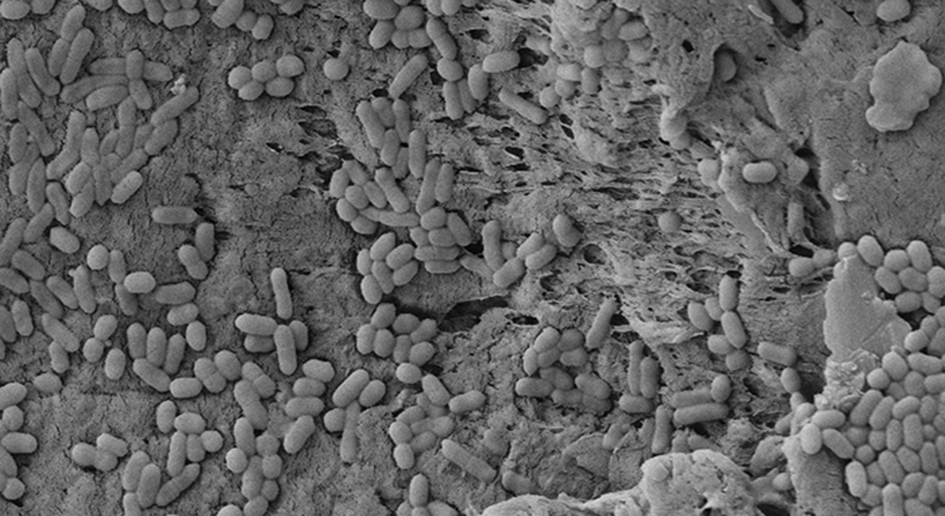 Microscopia electrónica del biofilm de Listeria monocytogenes, un patógeno de las heladeras