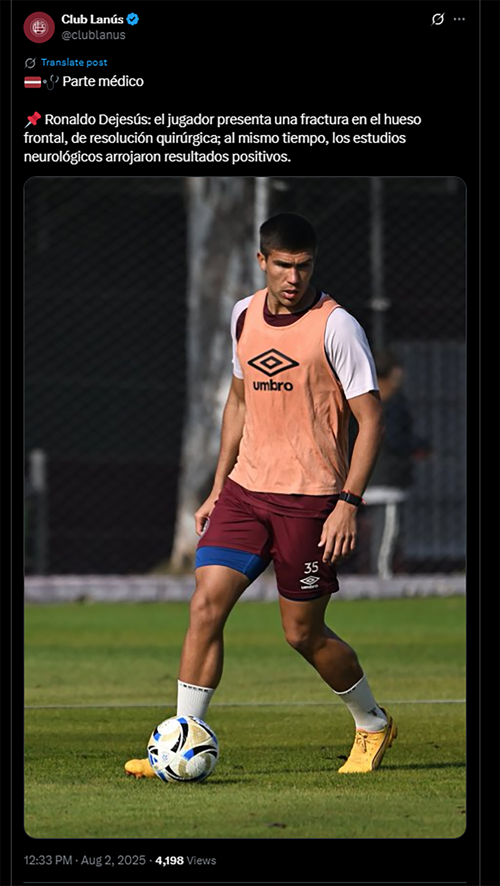 La preocupante lesión que sufrió un jugador de Lanús tras un choque de cabezas: será operado por una fractura