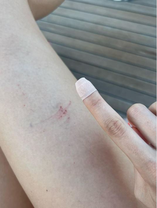 La actriz mostró los golpes que se dio durante su escalada. (Foto Instagram: @belindapop)