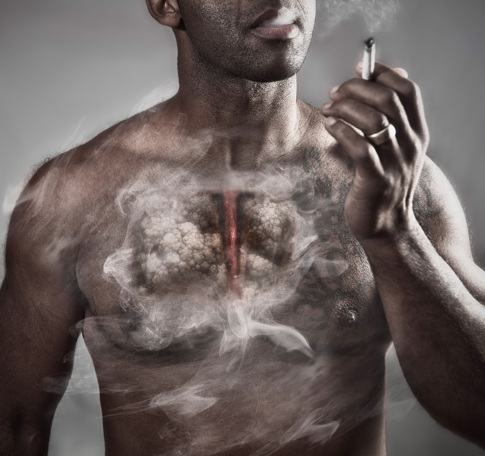 El tabaquismos es la principal causa de cáncer de pulmón