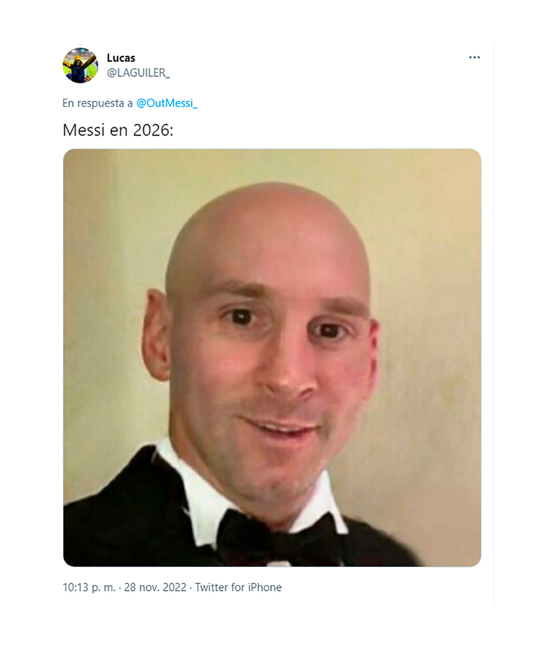 Otro se animó a mostrarlo sin pelo
