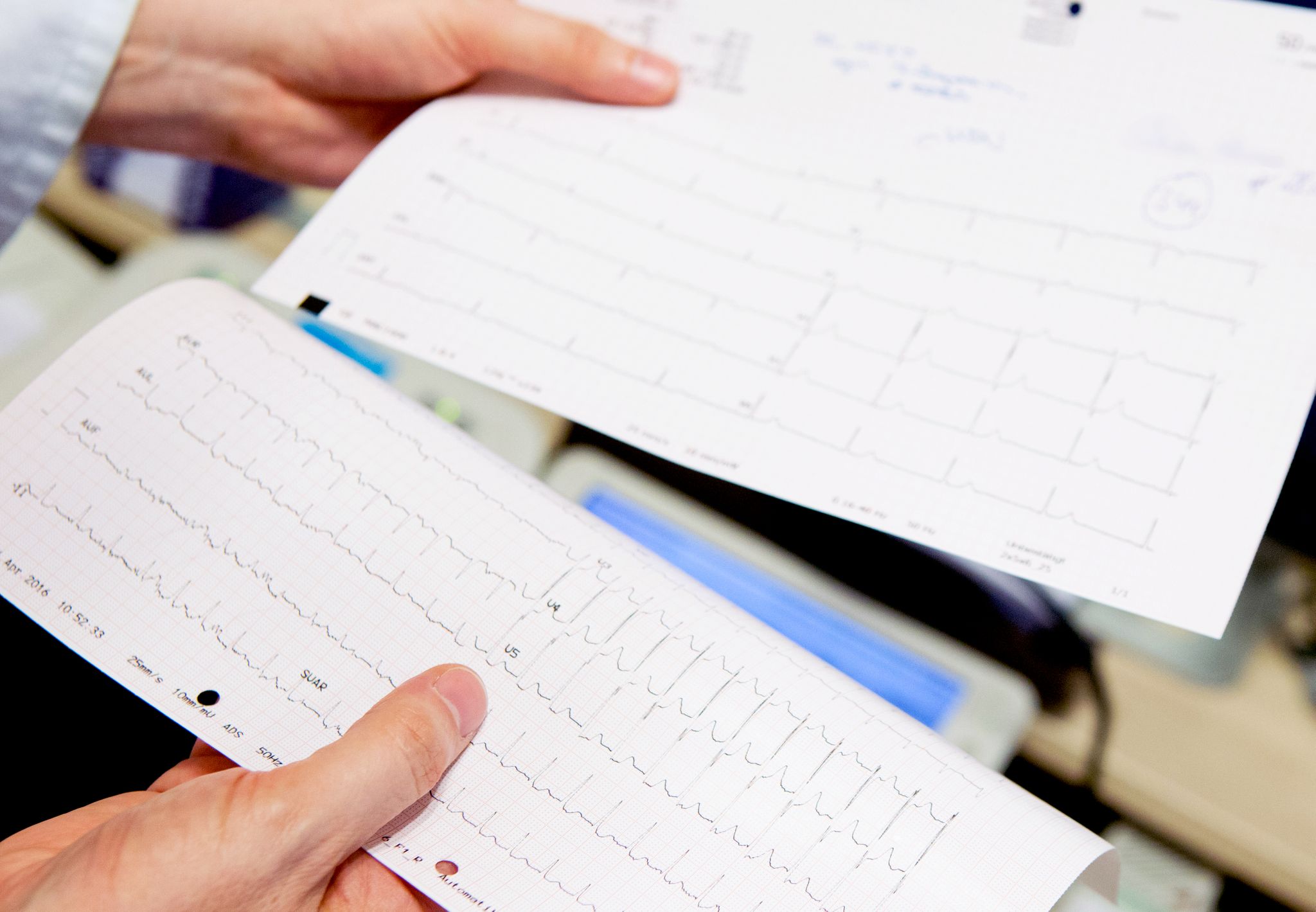 In the number of athletes present with cardiopulmonary symptoms, “the initial evaluation should be ideal with an ECG, cTn (biomarker troponina cardiaca) and an ecocardiogram (Photo: Oliver Krato / dpa)