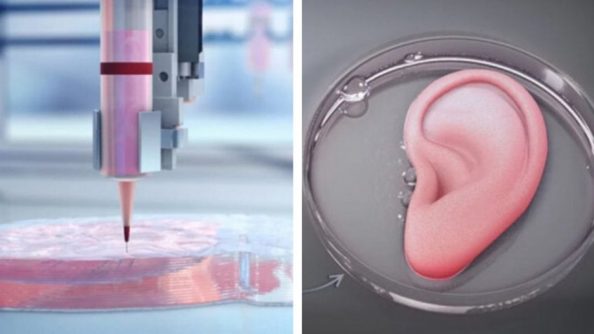 Lograron trasplantar una oreja impresa en 3D hecha de células humanas -  Infobae