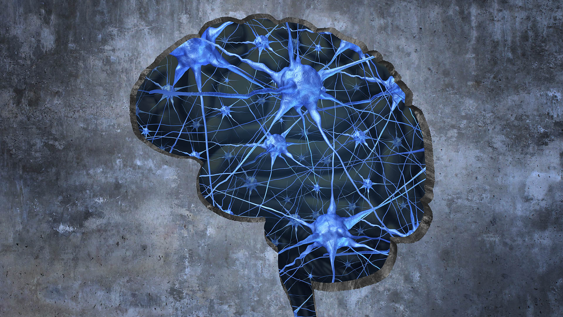 La estimulación cerebral podría revertir la pérdida de capacidad cognitiva relacionada con el Alzheimer