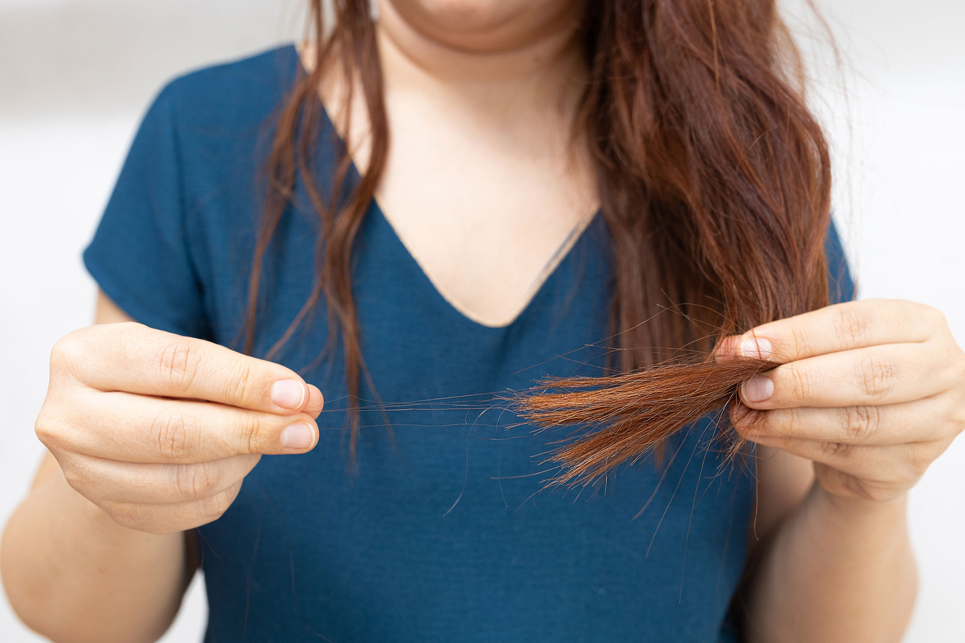 Tricotilomania es conocido como el trastorno de arrancarse el pelo
(Gentileza: Rocco)