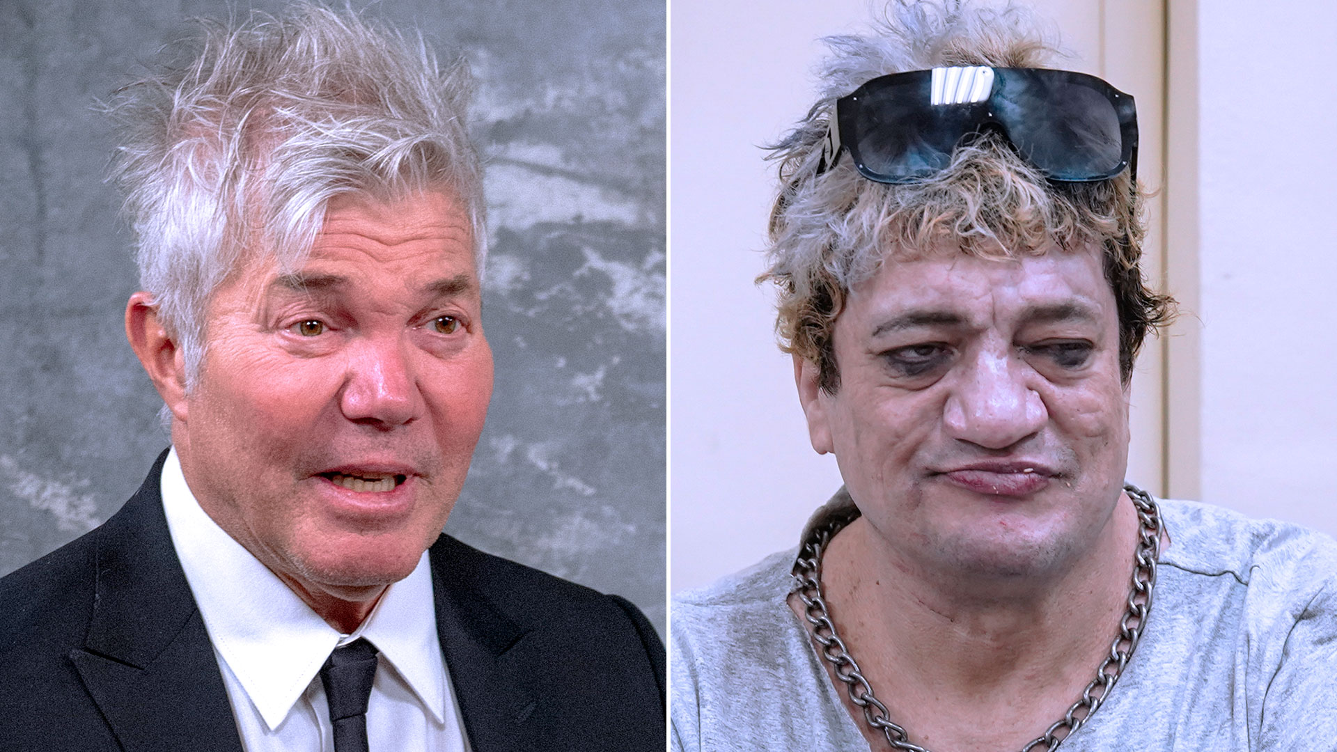 "Vas a empezar a usar dentadura postiza": la amenaza que recibió Fernando Burlando de un seguidor de "Pity" Álvarez