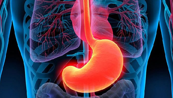 Cuáles son las causas de la gastritis erosiva y cómo es el tratamiento que se debe seguir, según los expertos
