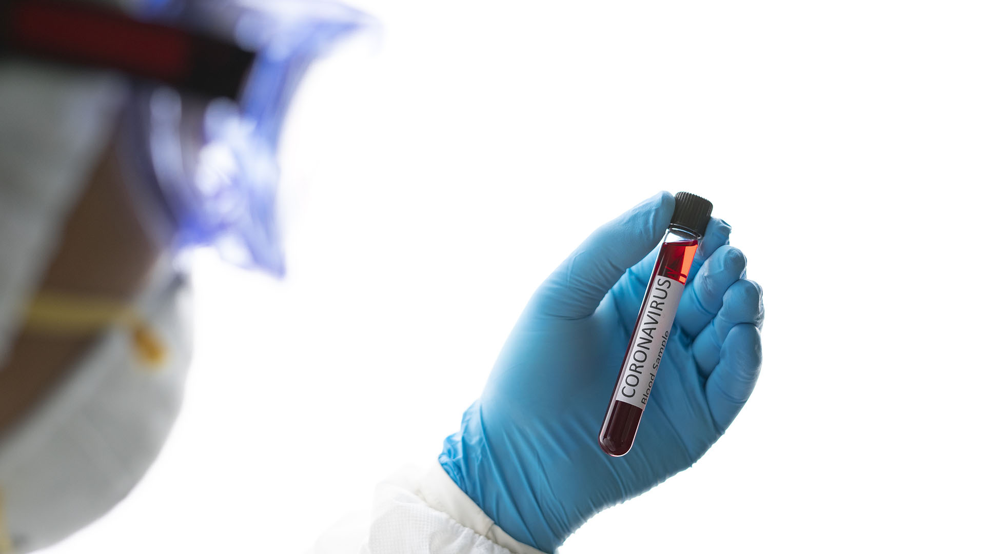 Les experts ont souligné qu'après la vaccination contre le COVID, les anticorps détectés dans le sang protègent contre les affections graves, mais ceux trouvés dans le nez peuvent prévenir l'infection / (Getty Images)
