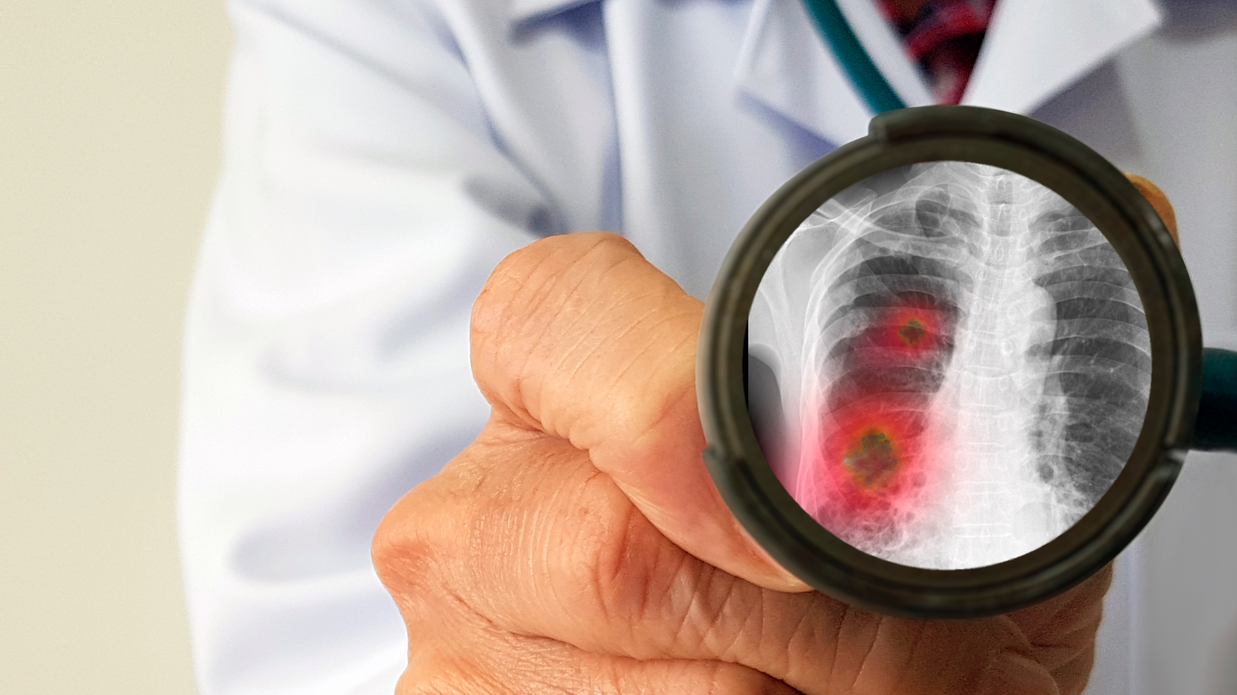 Las conclusiones de un reciente estudio dejan ver que en los pacientes que alcanzan cuadros graves de coronavirus la mecánica respiratoria está intacta (Shutterstock)