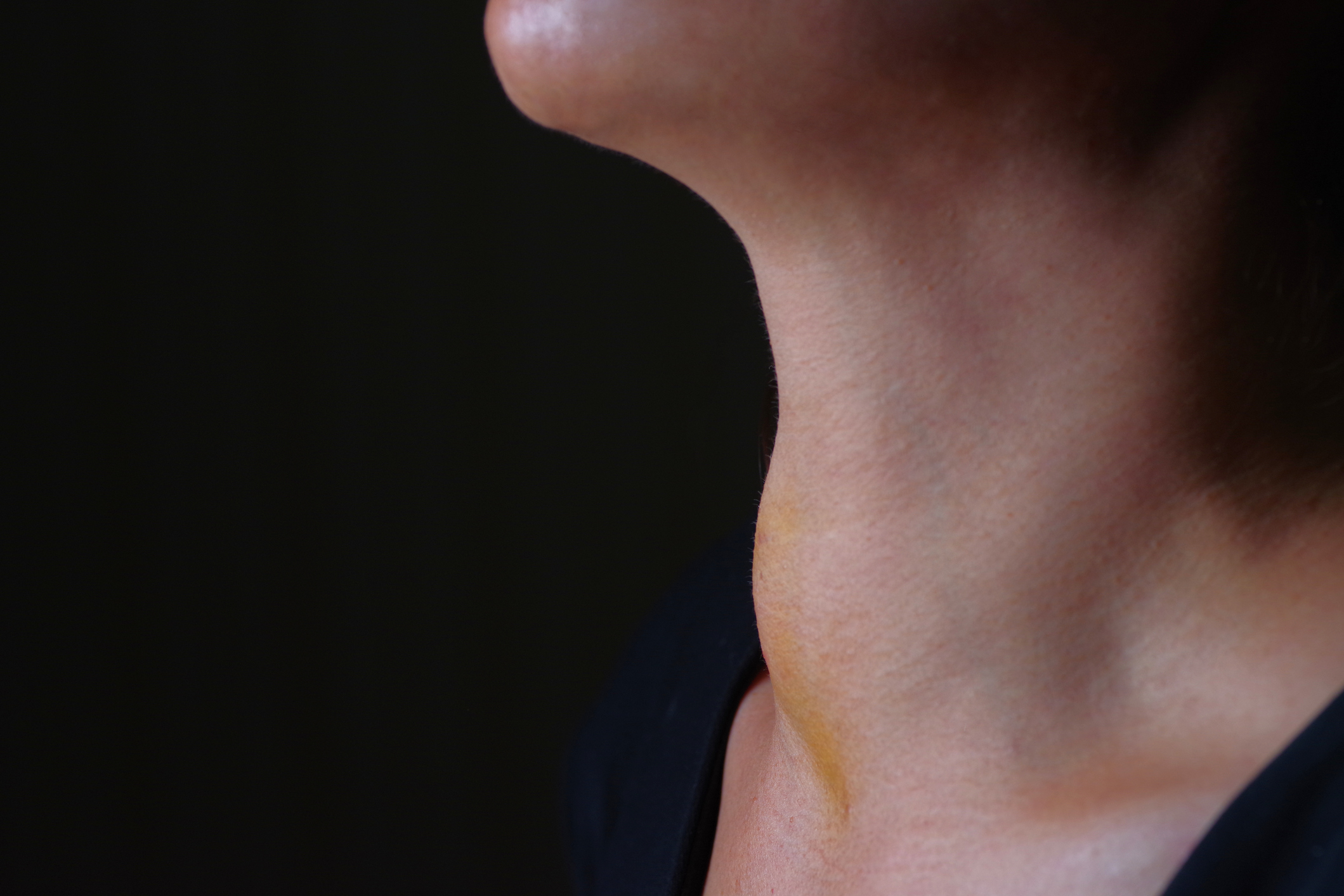 El hipotiroidismo es la segunda enfermedad endocrina más frecuente, después de la diabetes (Getty Images)