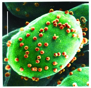Los clorovirus, como el que se come la Halteriia, también afectan a las algas (Kit Lee and Angie Fox)