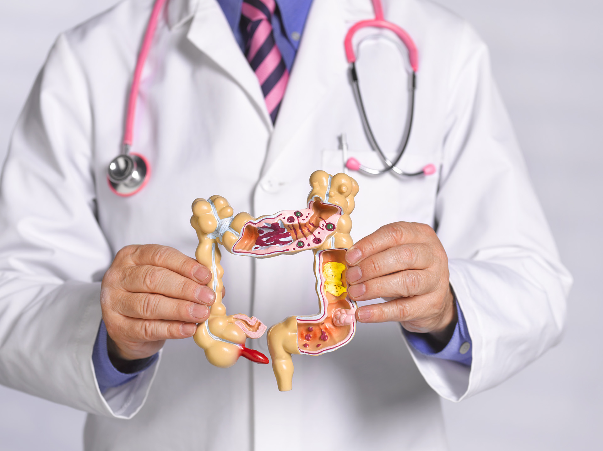 El cáncer de colon es prevenible, ya que detectado a tiempo, puede curarse en el 90% de los casos (Getty Images)
