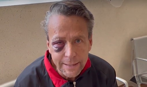 Alfredo Adame tiene cuatro fracturas en el rostro tras golpiza en Tepepan 