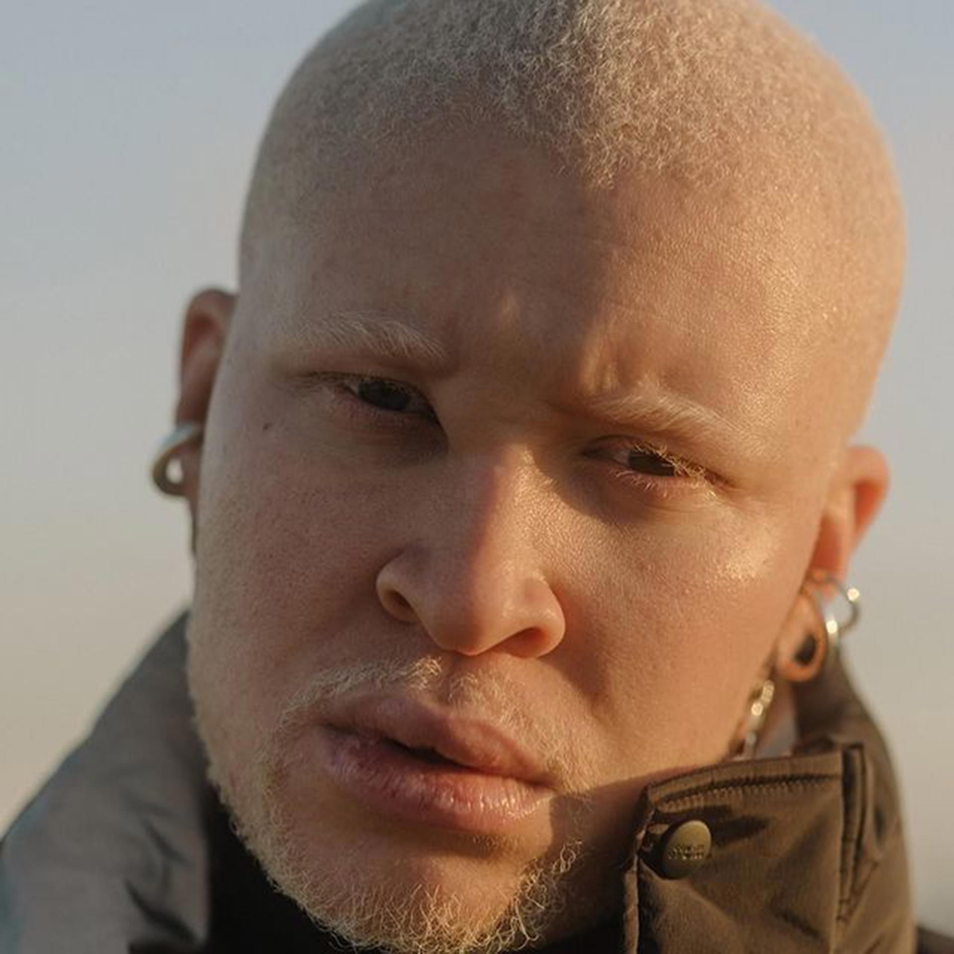 Shaun Ross, que tiene 663 mil seguidores en Instagram. Con 30 años es actor, artista y bailarín, y fue el primer modelo albino masculino