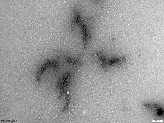Imagen de amiloide de la proteína espiga del virus SARS-CoV-2, vista con un microscopio electrónico (foto: Sofie Nyström y Per Hammarström)