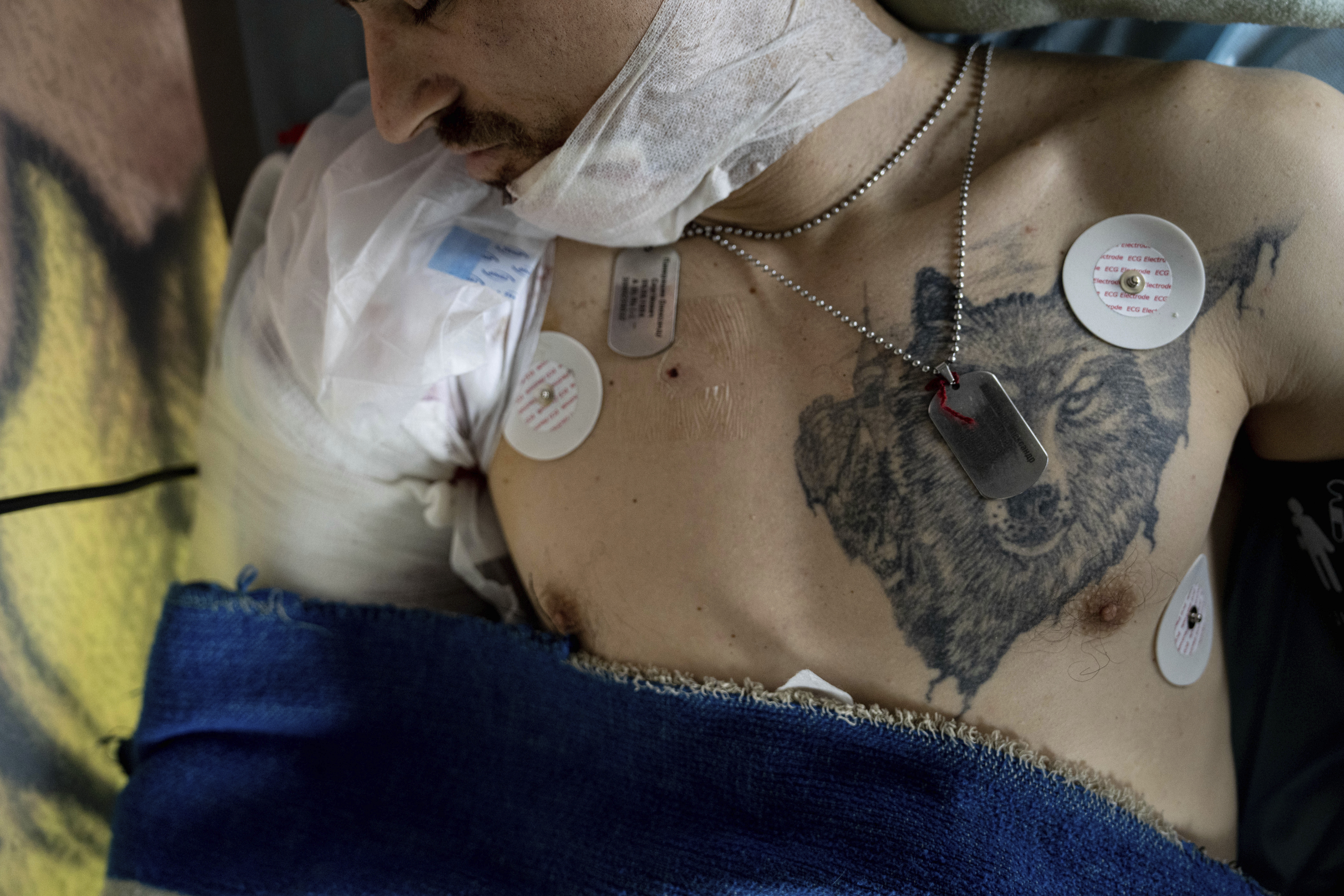 Oleksandr, un soldado ucraniano herido, se ve tumbado en la cama en un autobús medicalizado durante una evacuación de la organización paramédica de voluntarios Hospitallers, en la región de Donetsk, Ucrania, el miércoles 22 de marzo de 2023. (AP Foto/Evgeniy Maloletka)