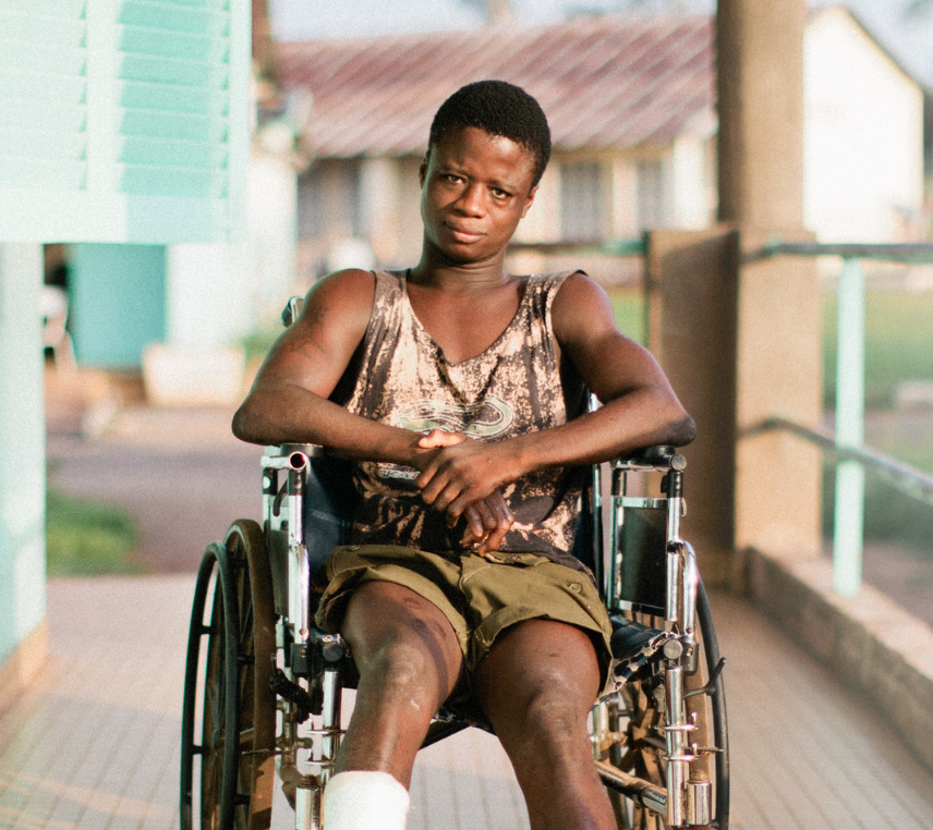 Si no se accede al tratamiento para la lepra, la enfermedad puede avanzar y generar discapacidad/OMS