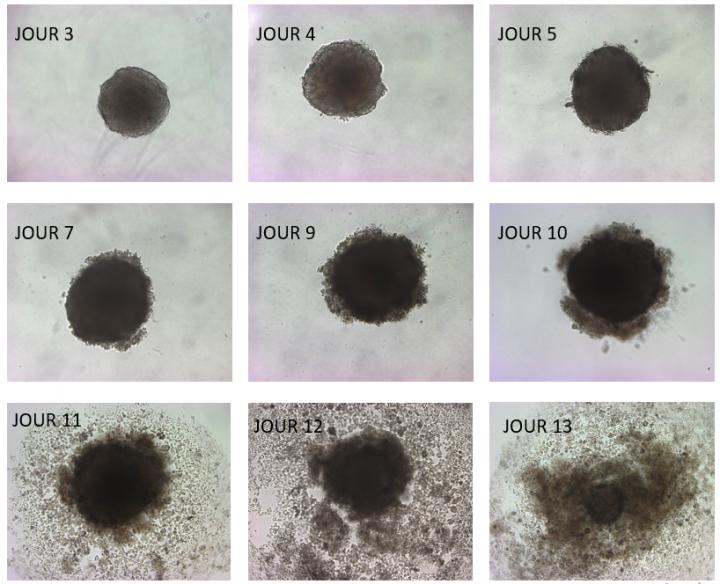 Los científicos hicieron una reconstrucción en 3D de la desintegración de los tumores a partir de la intervención con Omega-3 (DHA) que se encuentra en pescados. Destruyó a los tumores en ratones/Universidad Católica de Lovaina