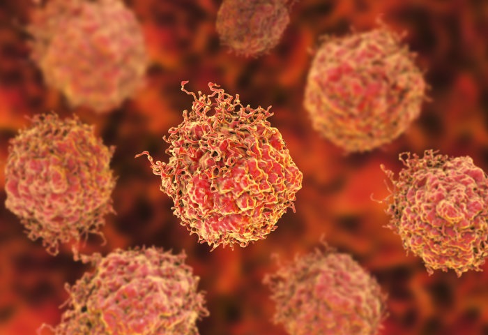 La investigación abre la puerta a desarrollar un nuevo tipo de detección de tumores graves con un análisis de orina. El trabajo fue publicado en la revista European Urology Oncology (IMPERIAL COLLEGE LONDON)
