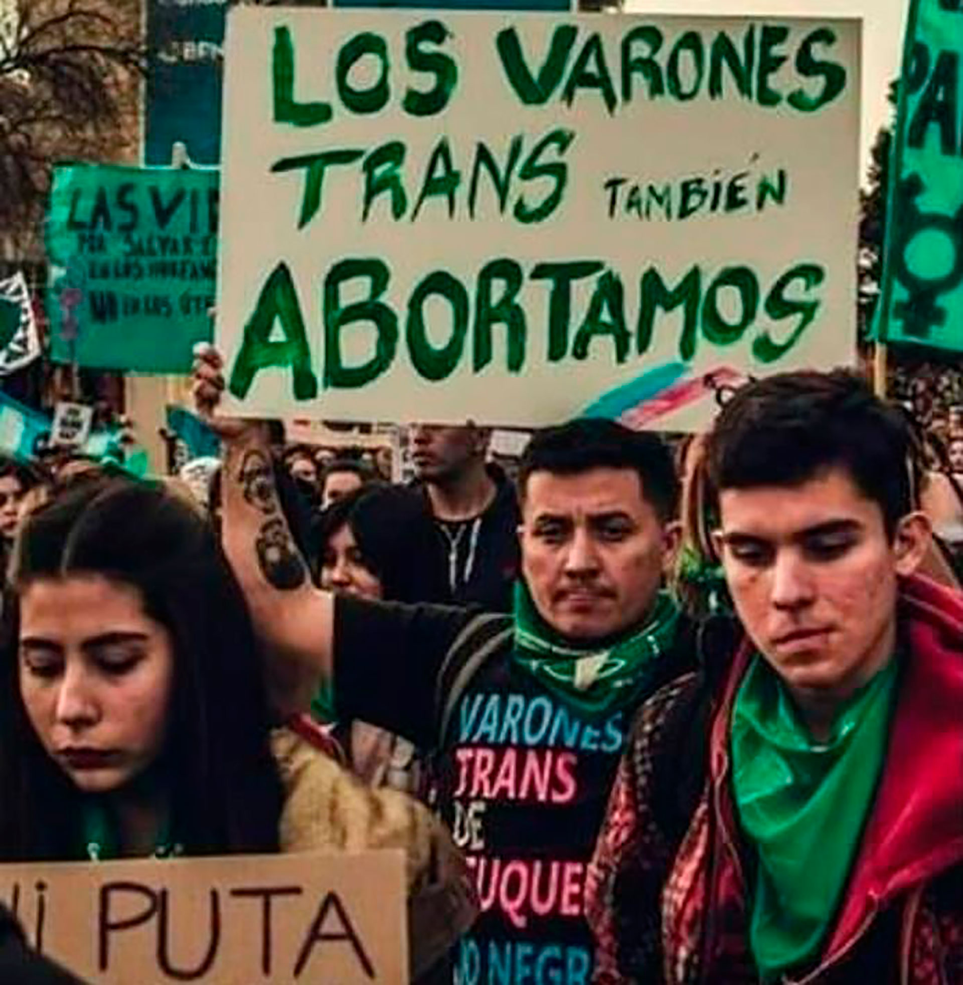 "Los varones trans también abortamos", es la frase que usan para visibilizar también las interrupciones de embarazos en ellos