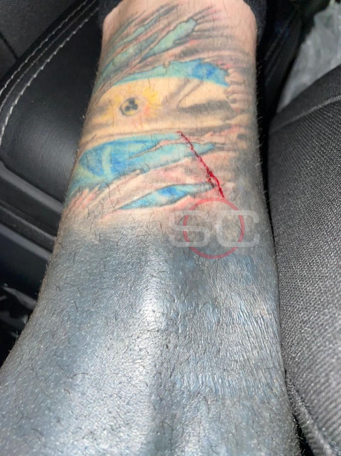 Jonathan Gomez's leg was left like this after Villa ironed.  Photo: SC