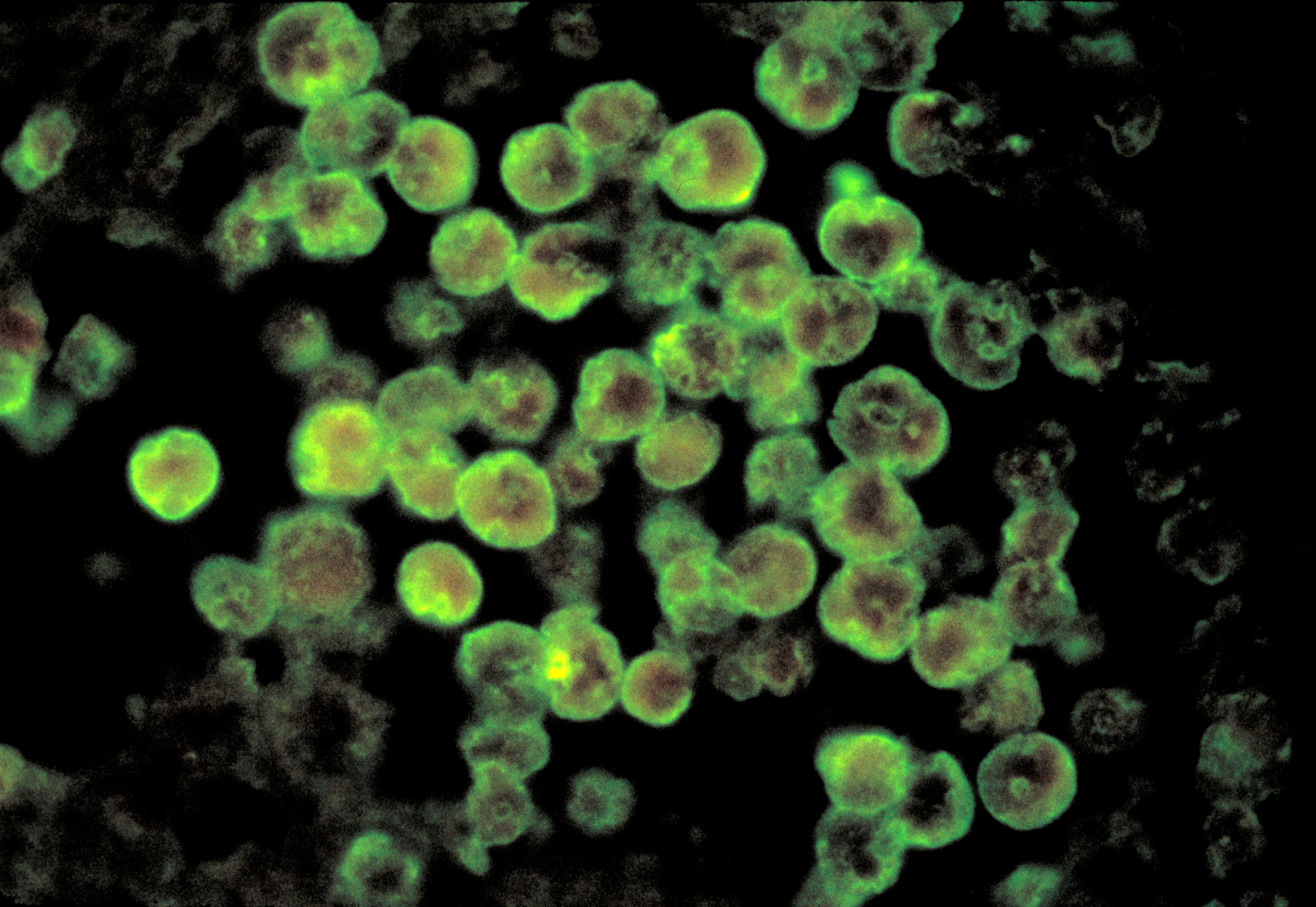 Estas amebas no sobreviven en aguas saladas y se alimentan de bacterias que se encuentran en estos lugaresCDC/Handout via REUTERS THIS IMAGE HAS BEEN SUPPLIED BY A THIRD PARTY.