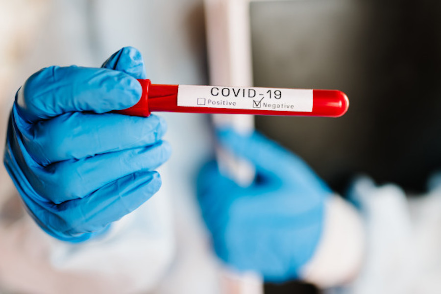 Para donar la sangre para el uso de plasma el paciente debió tener una infección por coronavirus y que la infección ya haya pasado. Foto: Gentileza.