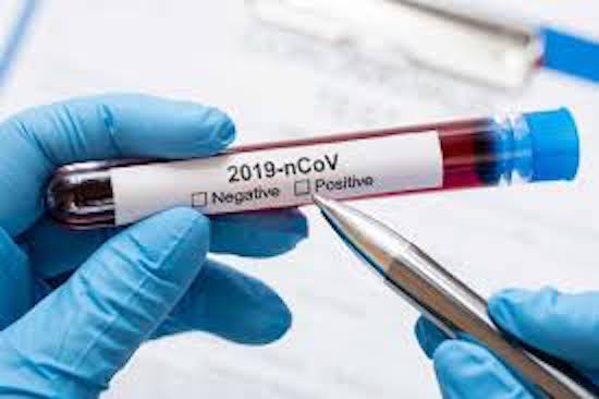El paciente podrá donar hasta 2 veces extrayendo 200 mililitros de su sangre. Foto: Gentileza. 