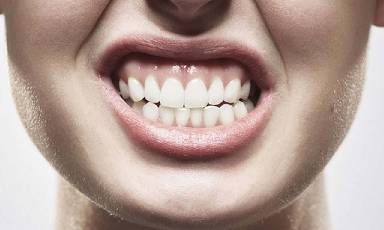 Bruxismo dental: causas, síntomas y tratamiento