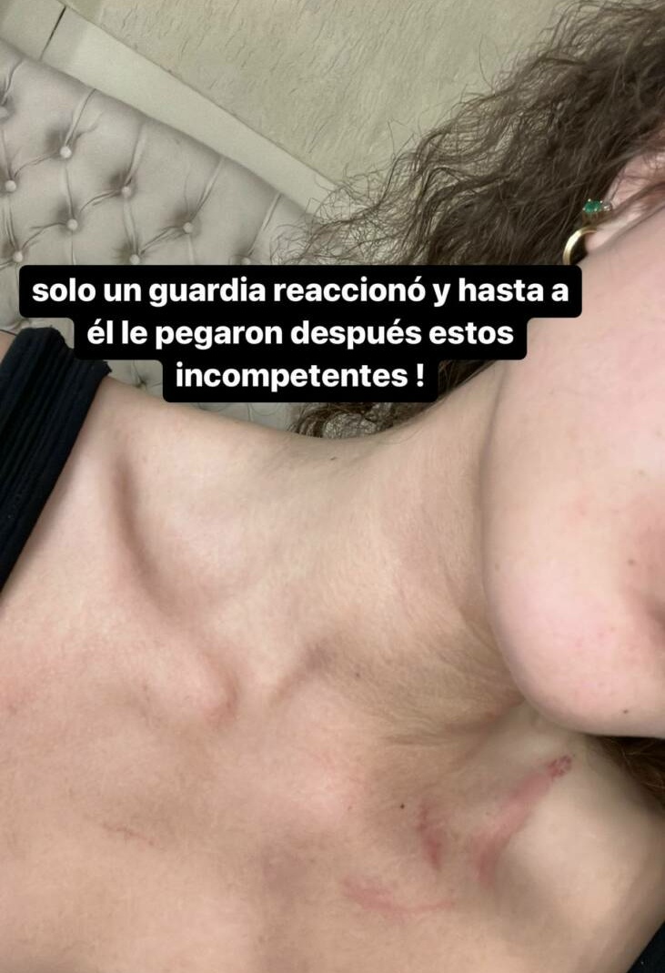 La yiyi mostró algunos rastros del ataque sufrido. (Foto: @ara.zelaya19)