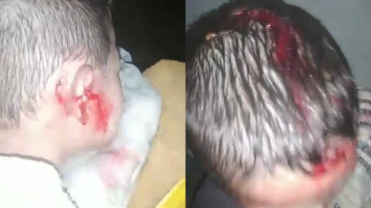 Varios niños resultaron con heridas en la cabeza a consecuencia de los granizos. Gentileza